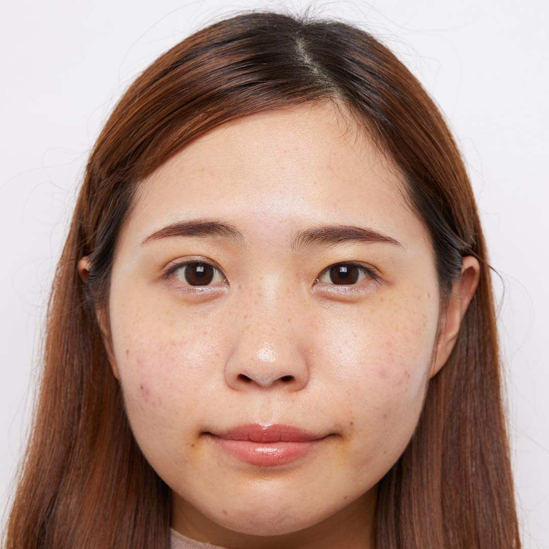 素肌